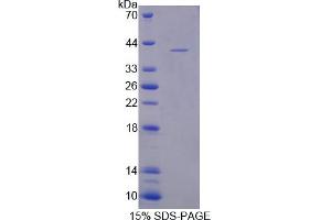 Image no. 1 for CART Prepropeptide (CARTPT) (AA 28-129) protein (His tag,GST tag) (ABIN6237683)