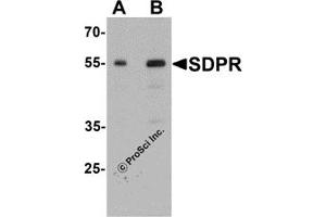 Western Blotting (WB) image for anti-Polymerase I and Transcript Release Factor (PTRF) (C-Term) antibody (ABIN1077453) (PTRF antibody  (C-Term))