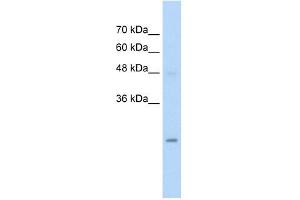 HIP2 antibody used at 5 ug/ml to detect target protein.