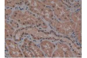 IHC-P analysis of Human Kidney Tissue, with DAB staining. (ATG7 antibody  (AA 429-488))