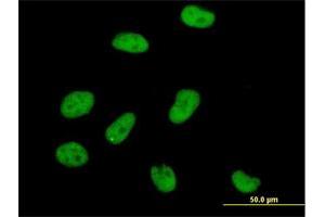 Immunofluorescence of purified MaxPab antibody to AOF2 on HeLa cell. (LSD1 antibody  (AA 1-876))