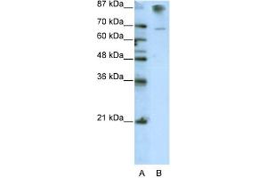 WB Suggested Anti-HKR1 Antibody Titration:  0. (HKR1 antibody  (C-Term))