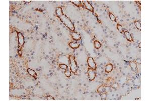 Immunohistochemistry (IHC) image for anti-Nucleophosmin (Nucleolar phosphoprotein B23, Numatrin) (NPM1) (pThr199) antibody (ABIN6256499)