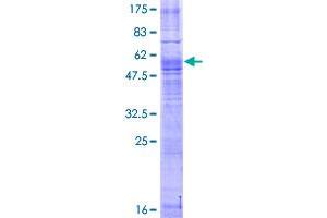 MAS1 Protein (AA 1-325) (GST tag)