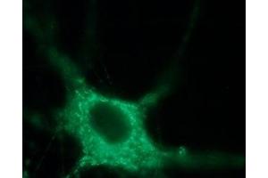 Expression of NaV1. (SCN9A antibody  (Intracellular))