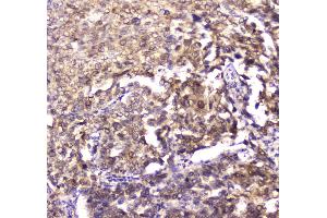 IHC analysis of 14-3-3 zeta/delta using anti-14-3-3 zeta/delta antibody . (14-3-3 zeta antibody)