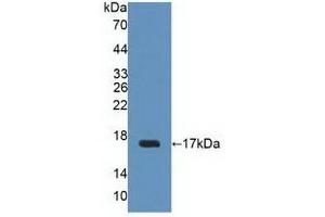 Detection of Recombinant UPK2, Human using Polyclonal Antibody to Uroplakin 2 (UPK2) (Uroplakin 2 antibody  (AA 26-153))
