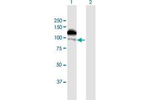 Western Blot analysis of ZFYVE16 expression in transfected 293T cell line by ZFYVE16 MaxPab polyclonal antibody. (ZFYVE16 antibody  (AA 1-809))
