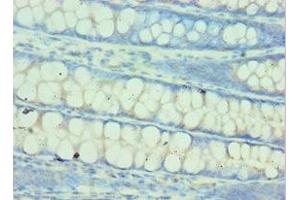 Immunohistochemistry of paraffin-embedded human colon tissue using ABIN7154026 at dilution of 1:100 (QARS antibody  (AA 1-250))