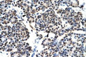 Image no. 1 for anti-Homeobox B5 (HOXB5) (N-Term) antibody (ABIN6735845) (HOXB5 antibody  (N-Term))