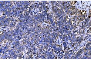 IHC analysis of ENAH/MENA using anti-ENAH/MENA antibody (ABIN7601316). (ENAH antibody  (AA 32-551))