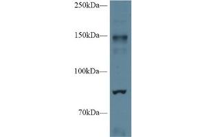 Detection of NOS2 in Mouse Cerebrum lysate using Polyclonal Antibody to Nitric Oxide Synthase 2, Inducible (NOS2)