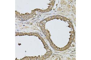 Immunohistochemistry of paraffin-embedded human prostate using ANXA8L2 antibody (ABIN5975720) at dilution of 1/100 (40x lens). (ANXA8L2 antibody)