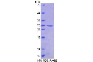 SDS-PAGE analysis of Human BCR Protein. (BCR Protein)