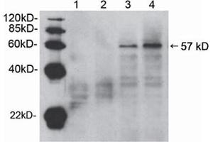 Western blot analysis of cell lysates from HEK-293 (lane 1 and 3) and NIH/3T3 (lane 2 and 4) cells,using Rabbit Anti-Akt (Ser473) Polyclonal Antibody (ABIN398622) . (AKT1 antibody  (pSer473))