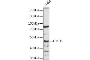Western blot analysis of extracts of HeLa cells, using GMDS antibody (ABIN6294083) at 1:1000 dilution.