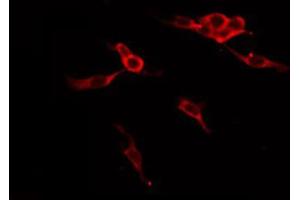 ABIN6274910 staining Hela by IF/ICC. (B4GALT1 antibody  (C-Term))