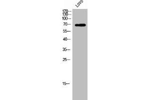 Western Blot analysis of LOVO cells using ZP1 Polyclonal Antibody (ZP1 antibody  (Internal Region))