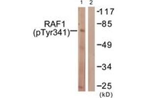 Western blot analysis of extracts from Jurkat cells treated with Paclitaxel 1uM 24h, using C-RAF (Phospho-Tyr341) Antibody.