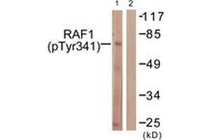 Western blot analysis of extracts from Jurkat cells treated with Paclitaxel 1uM 24h, using C-RAF (Phospho-Tyr341) Antibody. (RAF1 antibody  (pTyr341))