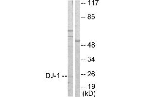 Western blot analysis of extracts from HuvEc cells, using DJ-1 antibody (#C0172). (PARK7/DJ1 antibody)