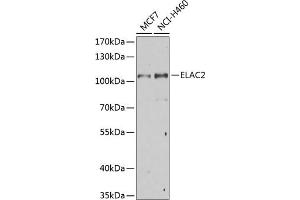 Western blot analysis of extracts of various cell lines, using EL Antibody (ABIN6132052, ABIN6140108, ABIN6140109 and ABIN6222942) at 1:1000 dilution. (ELAC2 antibody  (AA 1-270))