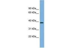 Image no. 1 for anti-Fructose-1,6-Bisphosphatase 2 (FBP2) (C-Term) antibody (ABIN6744847) (FBP2 antibody  (C-Term))