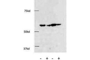 Western Blotting (WB) image for anti-Histone Deacetylase 1 (HDAC1) (AA 449-482), (C-Term) antibody (ABIN387945)