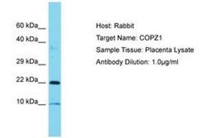 Image no. 1 for anti-Coatomer Protein Complex, Subunit zeta 1 (COPZ1) (C-Term) antibody (ABIN6750829) (COPZ1 antibody  (C-Term))