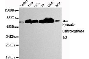 Western blot detection of Pyruvate Dehydrogenase E2 in Jurkat,A549,,F9,Lncap and Hela cell lysates using Pyruvate Dehydrogenase E2 mouse mAb (1:1000 diluted).