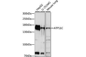 Western blot analysis of extracts of various cell lines, using C antibody (ABIN7265757) at 1:1000 dilution. (ATP11C antibody  (AA 430-650))