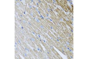Immunohistochemistry of paraffin-embedded mouse heart using MTX2 antibody at dilution of 1:100 (x40 lens). (MTX2 antibody)