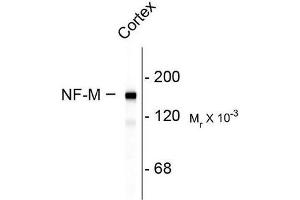 Image no. 1 for anti-Neurofilament Triplet M Protein (NEFM) (C-Term) antibody (ABIN372674) (NEFM antibody  (C-Term))