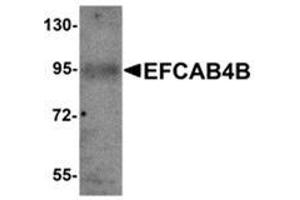 Western blot analysis of EFCAB4B in mouse kidney tissue lysate with EFCAB4B antibody at 1 μg/ml. (EFCAB4B antibody  (C-Term))