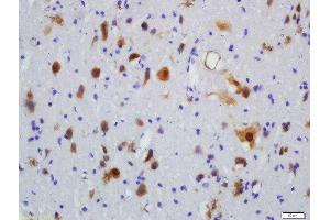 Formalin-fixed and paraffin embedded rat brain labeled with Rabbit Anti-Robo4 Polyclonal Antibody, Unconjugated  at 1:200 followed by conjugation to the secondary antibody and DAB staining