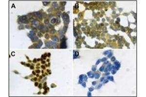 Immunohistochemistry (IHC) image for anti-S100 Calcium Binding Protein A7 (S100A7) antibody (ABIN400722) (S100A7 antibody)