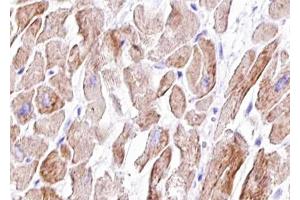 ABIN6267417 at 1/100 staining human Heart muscle tissue sections by IHC-P. (Vinculin antibody  (pTyr822))