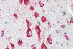 Human Brain, Cortex: Formalin-Fixed, Paraffin-Embedded (FFPE) (RPS12 antibody  (AA 15-44))