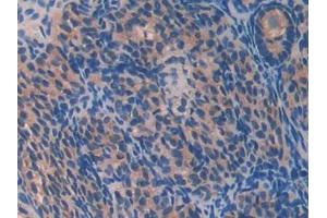 DAB staining on IHC-P; Samples: Mouse Ovary Tissue (PON2 antibody  (AA 4-289))