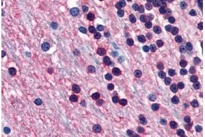 Human Brain, Cerebellum (formalin-fixed, paraffin-embedded) stained with ENO2 antibody ABIN364284 at 20 ug/ml followed by biotinylated anti-mouse IgG secondary antibody ABIN481714, alkaline phosphatase-streptavidin and chromogen. (ENO2/NSE antibody)