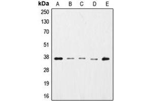 Western blot analysis of GAPDH expression in HepG2 (A), K562 (B), NIH3T3 (C), Raw264. (GAPDH antibody  (N-Term))