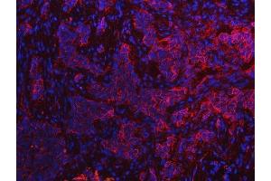 IF analysis of S100A10 using anti-S100A10 antibody (ABIN5692833). (S100A10 antibody  (AA 4-94))