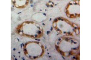 Used in DAB staining on fromalin fixed paraffin-embedded Kidney tissue (BMPR2 antibody  (AA 27-150))