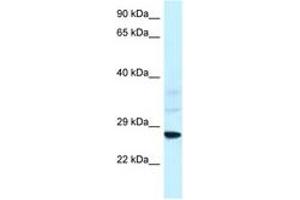 Image no. 1 for anti-Vacuolar-sorting Protein SNF8 (SNF8) (AA 25-74) antibody (ABIN6747424) (SNF8 antibody  (AA 25-74))