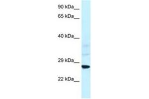 Image no. 1 for anti-Vacuolar-sorting Protein SNF8 (SNF8) (AA 25-74) antibody (ABIN6747424)