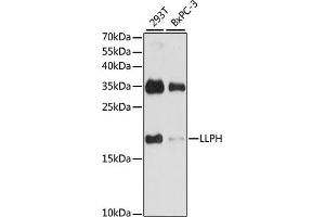 Western blot analysis of extracts of various cell lines, using LLPH antibody (ABIN7268290) at 1:1000 dilution. (LLPH antibody  (AA 1-129))