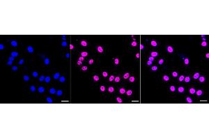 Immunocytochemical staining of HepG2 cells with Phospho-mTOR (S) antibody (ABIN7799349), 1:1,000). (Recombinant MTOR antibody  (pSer2481))