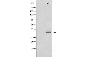 Western blot analysis of Caspase 3 phosphorylation expression in Etoposide treated Jurkat whole cell lysates,The lane on the left is treated with the antigen-specific peptide. (Caspase 3 antibody  (pSer150))