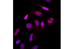 Immunofluorescence (IF) image for anti-Small Ubiquitin Related Modifier 2 (SUMO2) (AA 1-93), (N-Term) antibody (ABIN492386) (SUMO2 antibody  (N-Term))