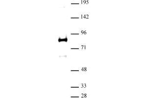 XRCC1 antibody (pAb) tested by Western blot. (XRCC1 antibody  (N-Term))